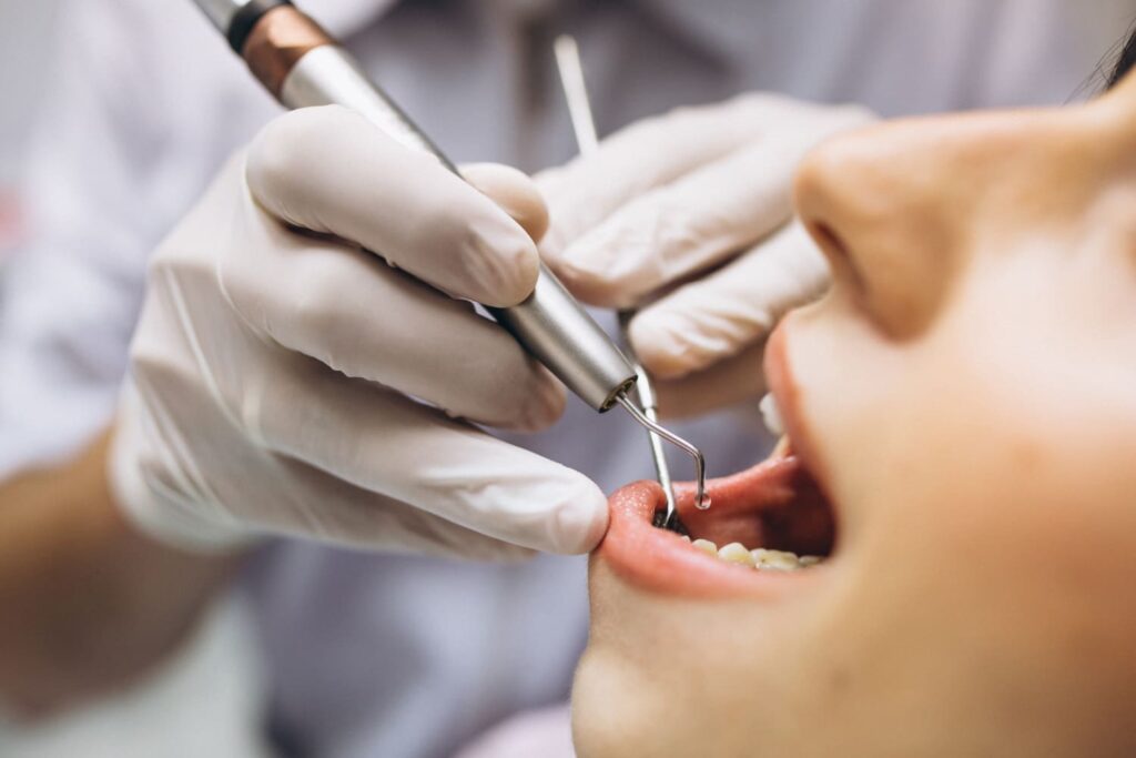 Root Canal Treatment