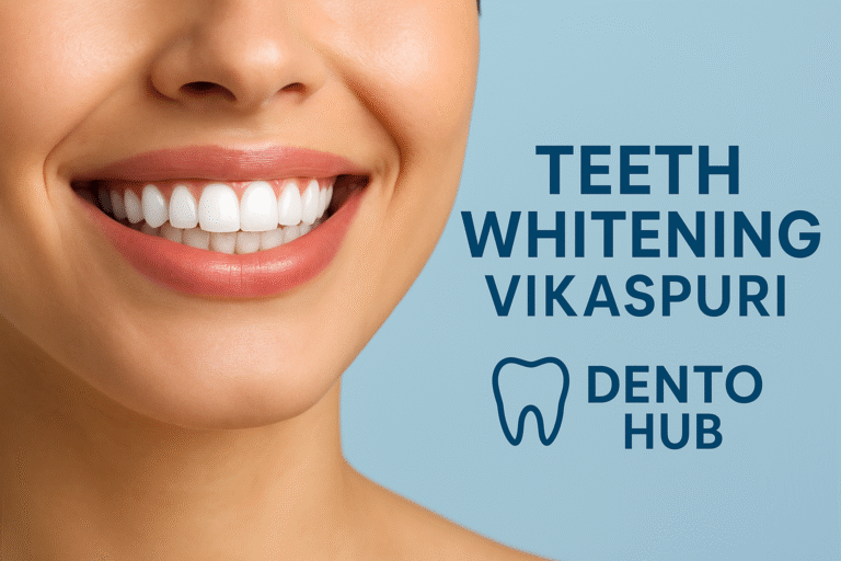 Teeth Whitening Vikaspuri