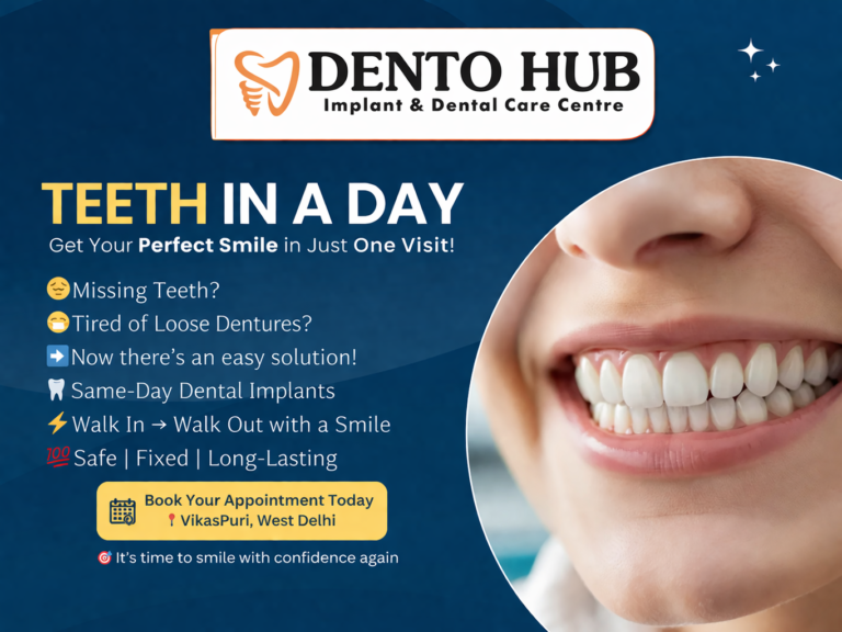 Tooth Implant in Vikaspuri | Teeth in a Day in Delhi – Same Day Smile